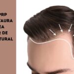 Smart-PRP-Hair-Restaura-tu-linea-capilar-de-forma-natural-1-2.jpg