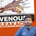 venous-leak-treatment.jpg