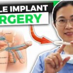 penile-implant-surgery.jpg
